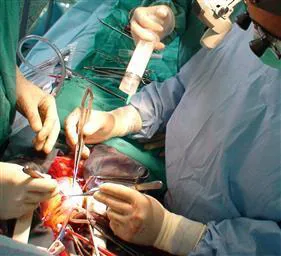 یازدهمین عمل موفقیت آمیز پیوند قلب به جوان 27 ساله جانی دوباره بخشید